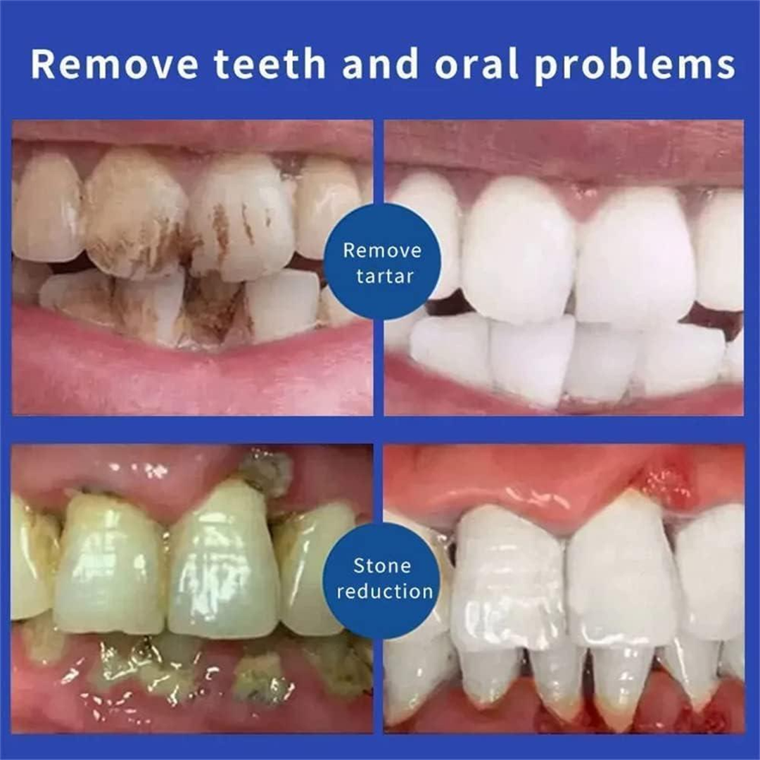 SP6 Probiotic Whitening Toothpaste | Fluoride-Free | 100g