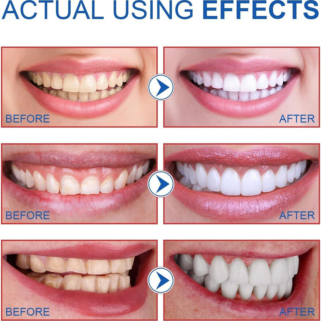 SP6 Probiotic Whitening Toothpaste | Fluoride-Free | 100g