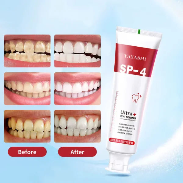 S4 Toothpaste SP-4 Ultra+ Probiotic Whitening Toothpaste – MLE Trend